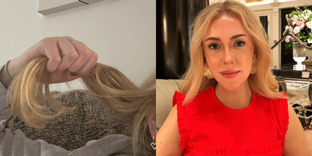 I’ve spent 6 months tackling seasonal hair shedding - here’s what actually works