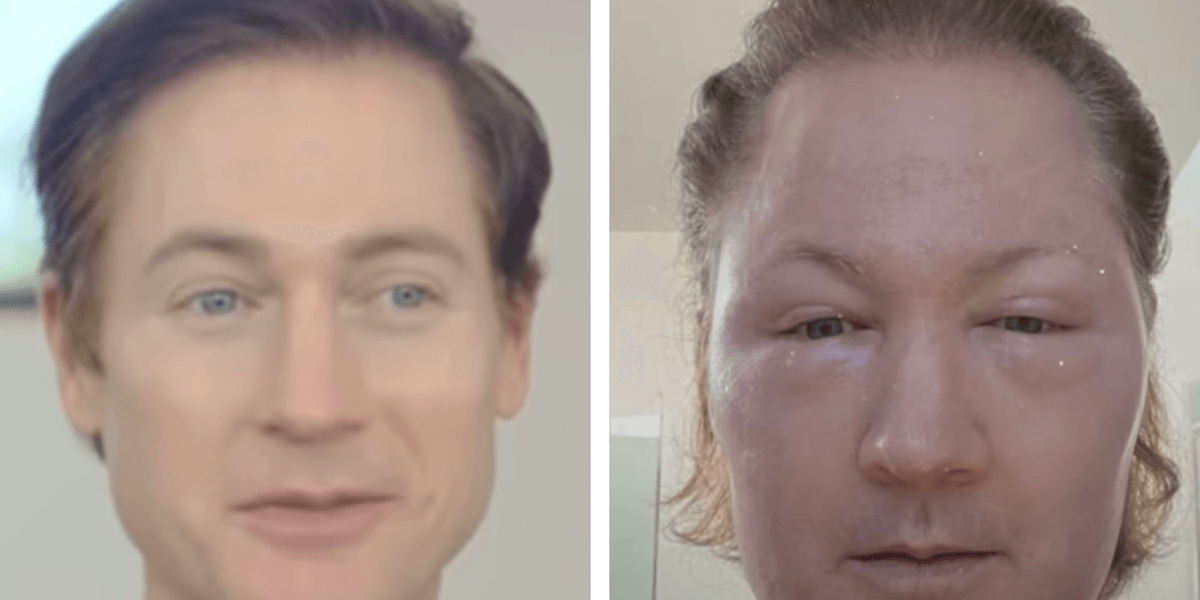 Biohacking Bryan Johnson sparks debate as he shares dramatic new ...