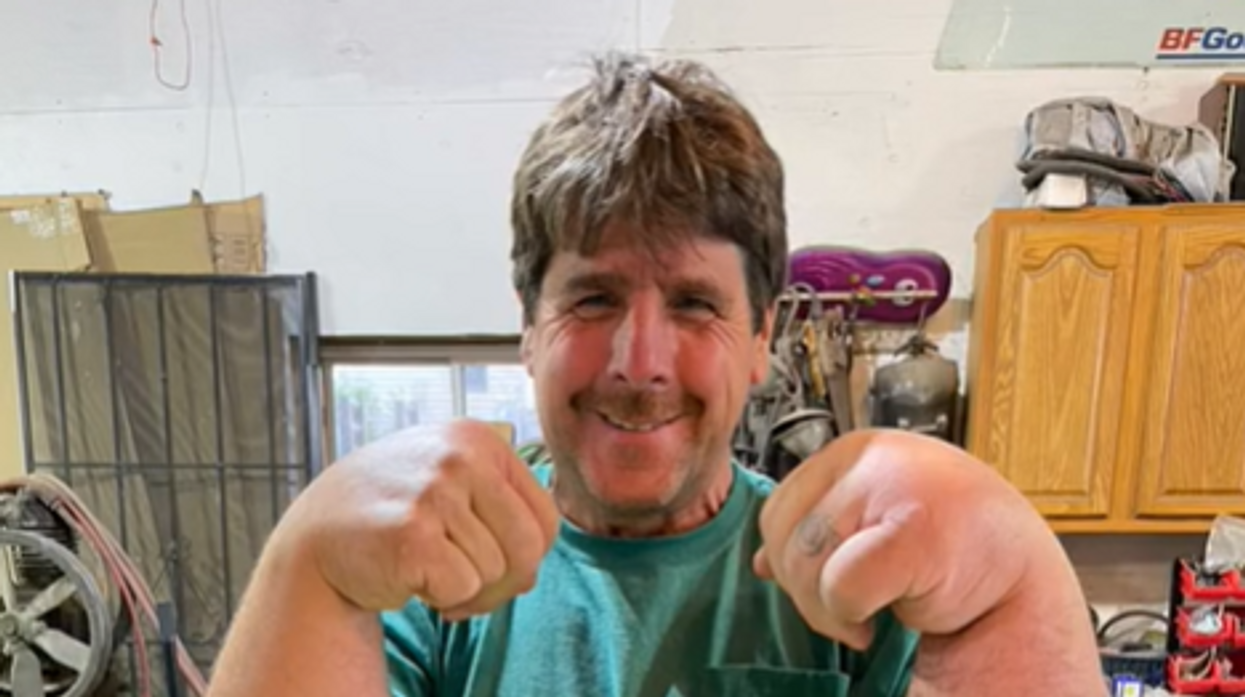 Man born with massive hands and arms continues to baffle experts