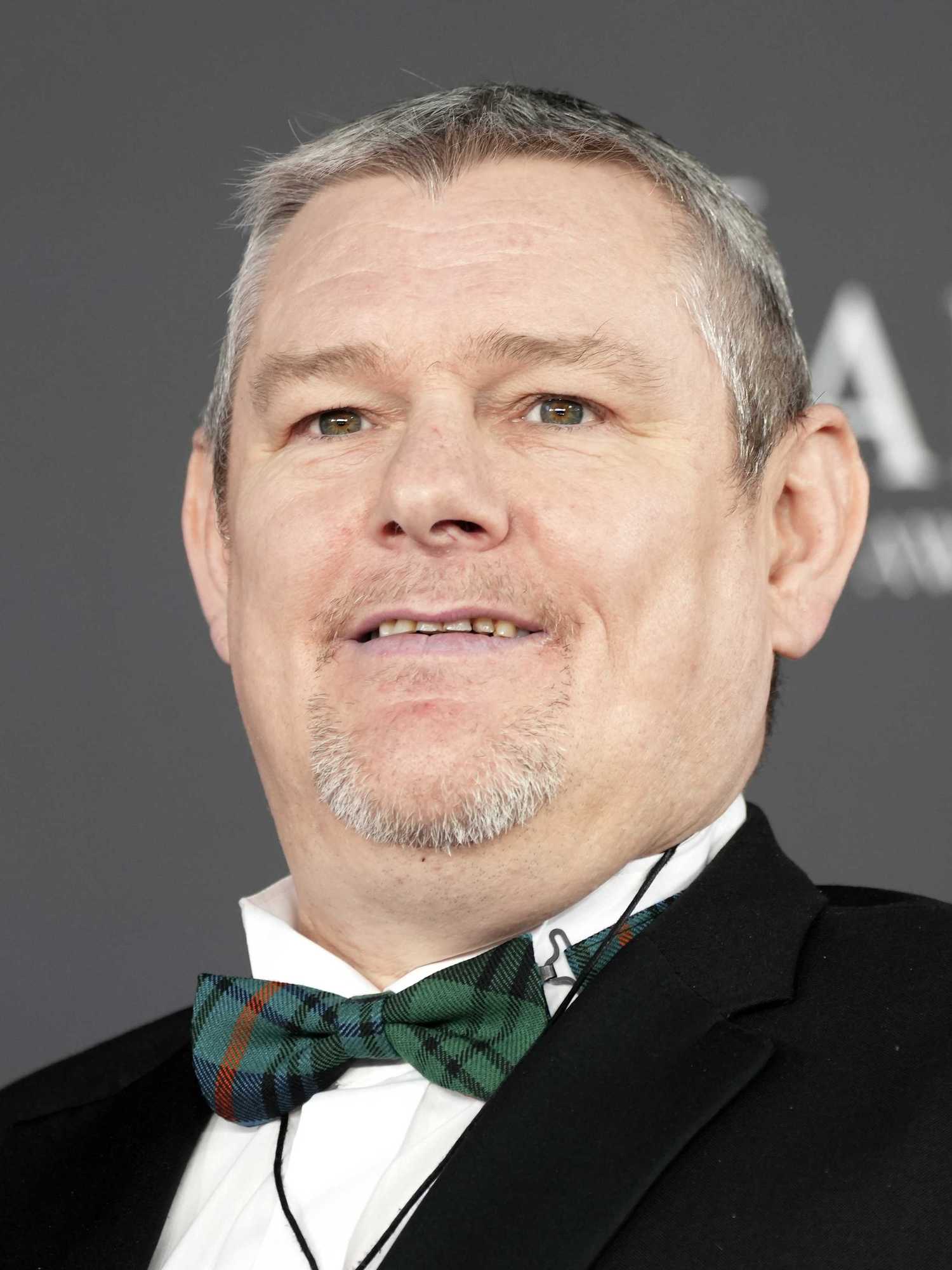 John Davidson raises questions of BBC after Bafta's Tourette debacle