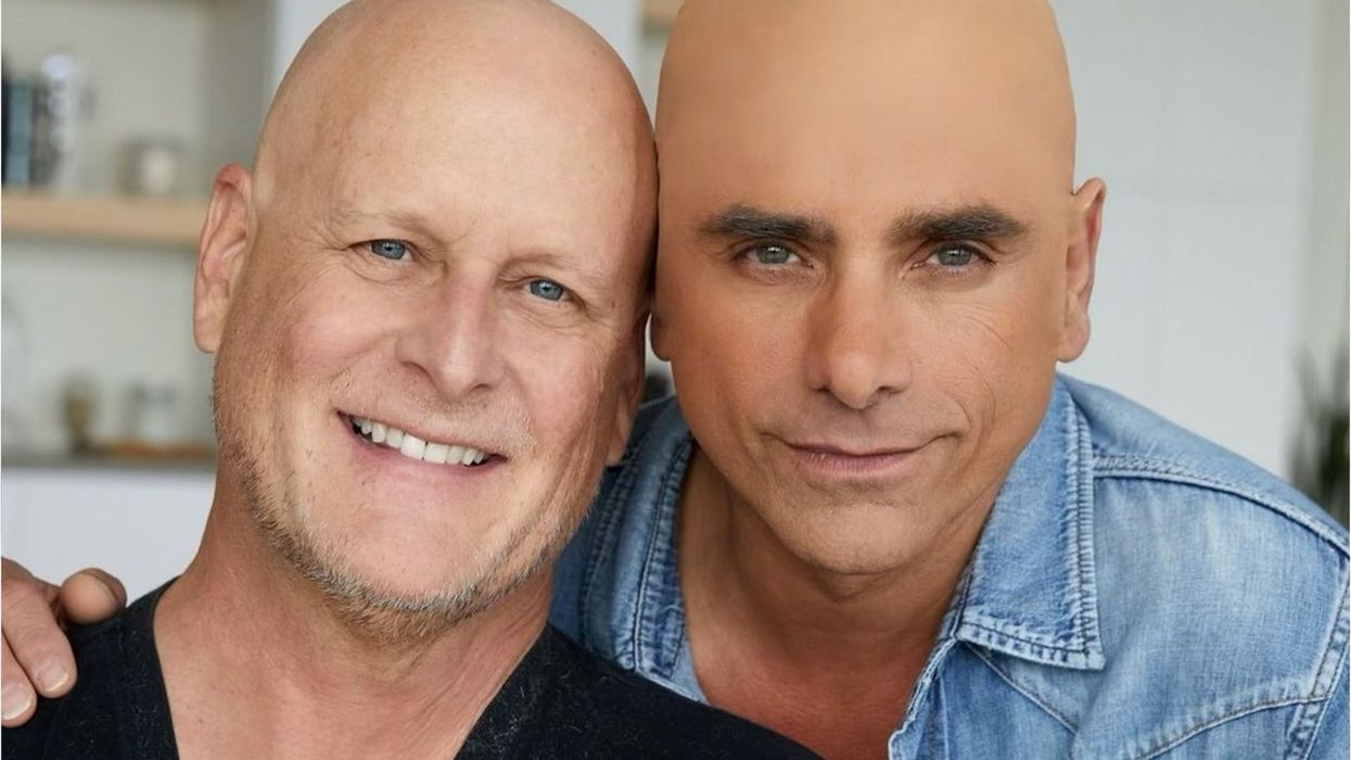 John Stamos faces backlash for wearing a bald cap in 'solidarity' as co-star faces cancer