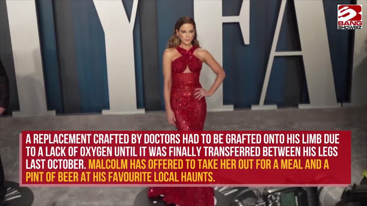 Kate Beckinsale invited on a date with the man who grew a penis on his arm