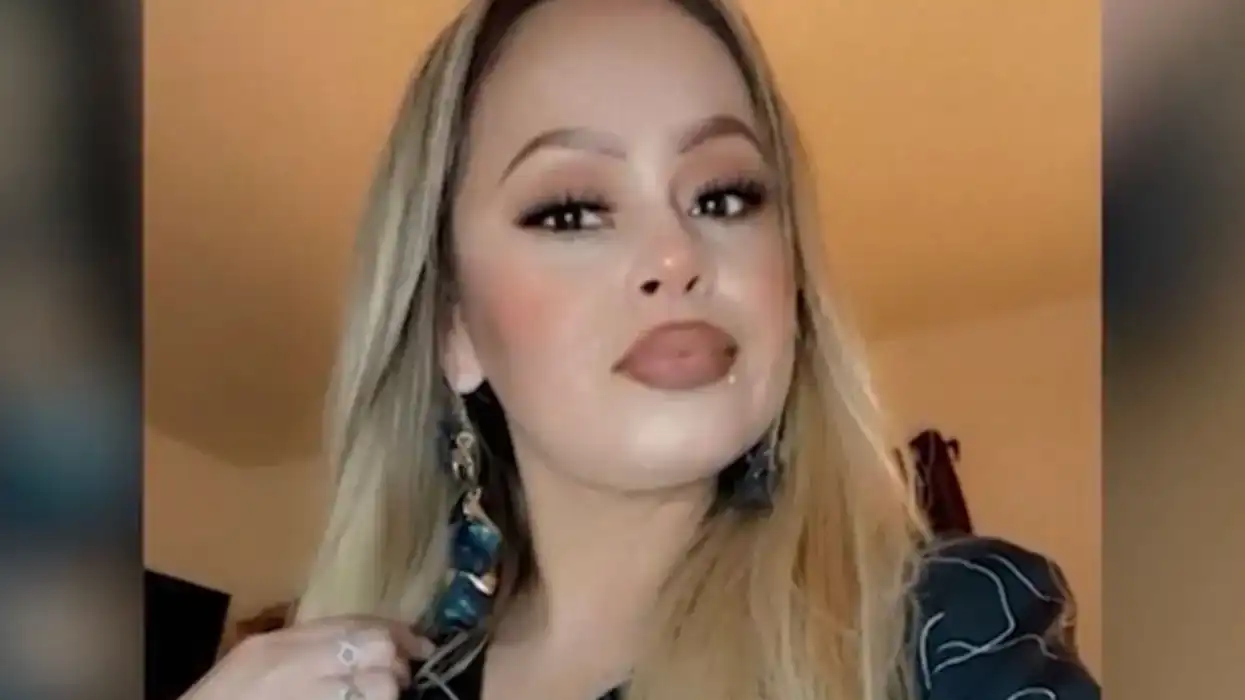 Mum has all of her limbs amputated after cooking fish containing flesh-eating bacteria