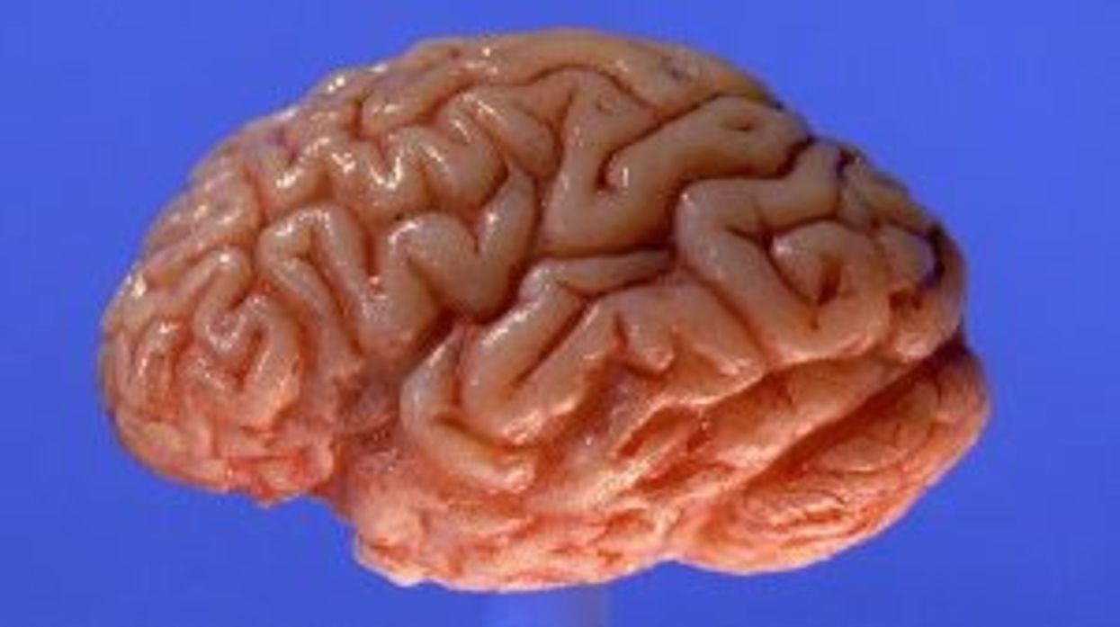 The world's shortest IQ test will reveal your intelligence just in 3 questions