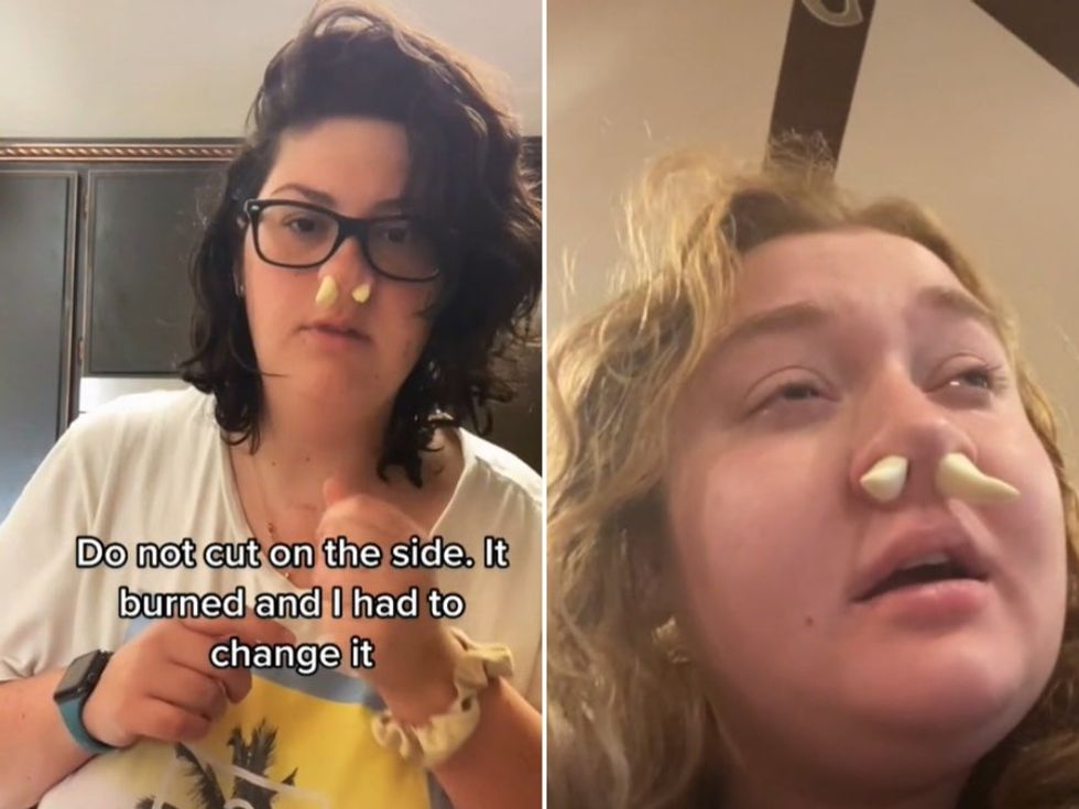 Please don’t do TikTok ‘hack’ and put garlic cloves up your nose