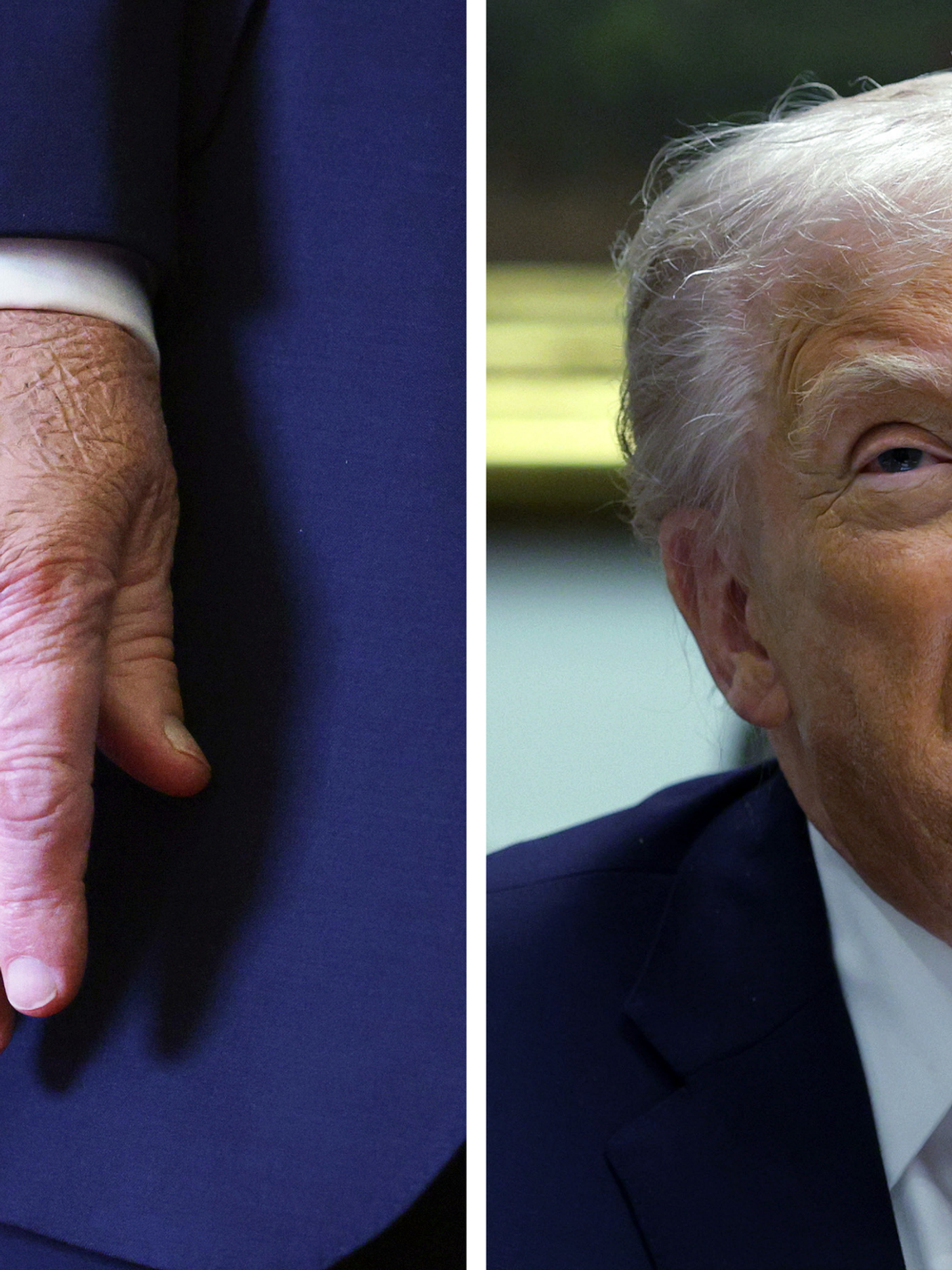 Left, Donald Trump's right hand with a bandage on the back of it. Right, Donald Trump frowning mid-speech.