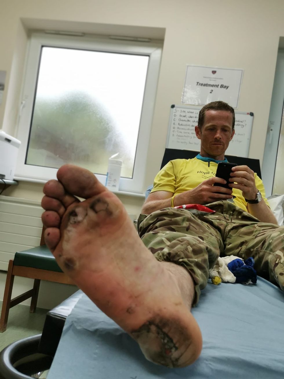 Major Chris Brannigan suffered blisters and infections during his previous barefoot trek (Chris Brannigan/PA)