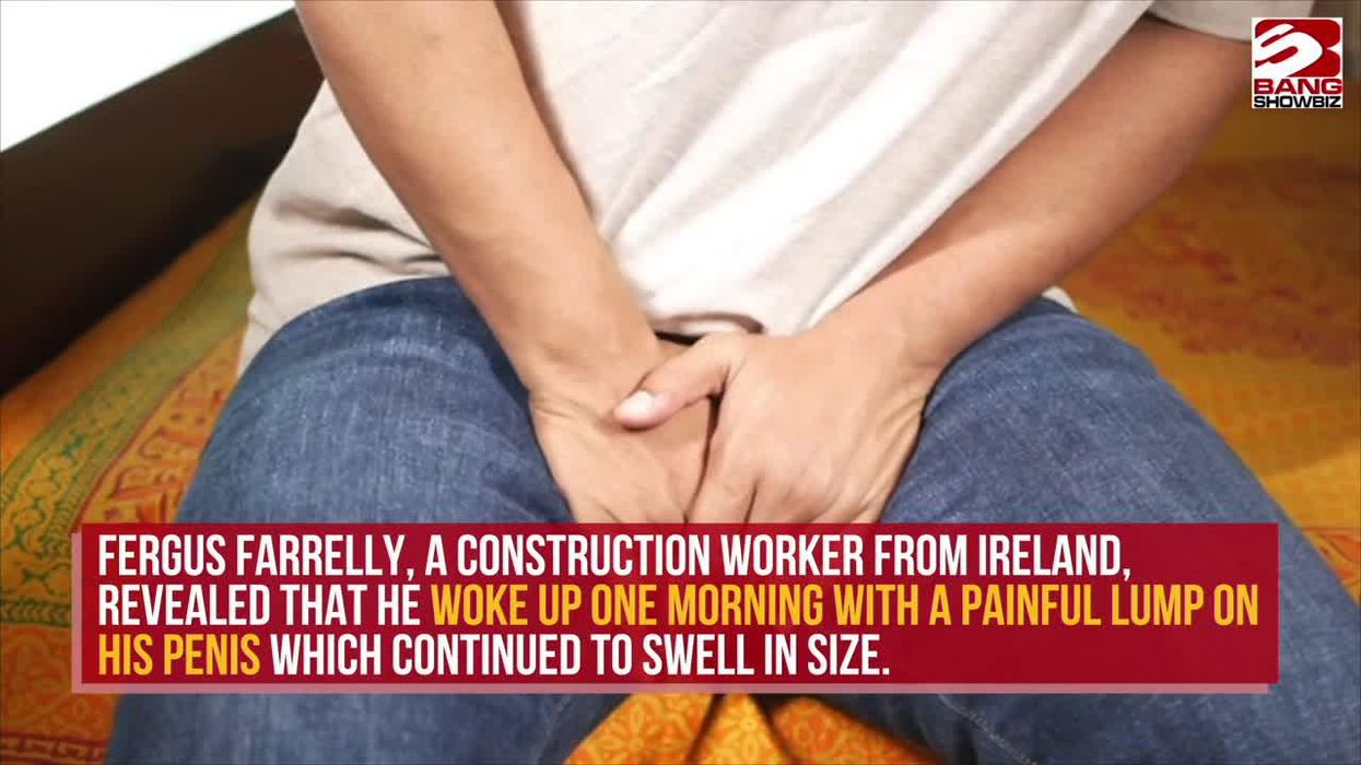 Study finds that electrocuting a penis may help prevent premature ejaculation