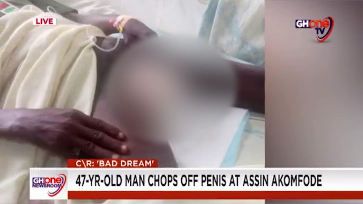 Man chops off his own penis while dreaming of cutting meat