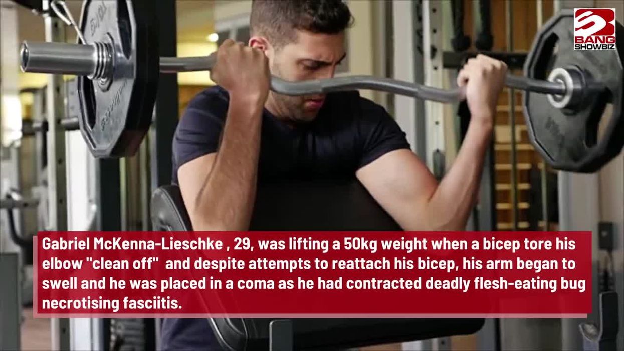 Man gets flesh-eating disease after getting bitten by a family member