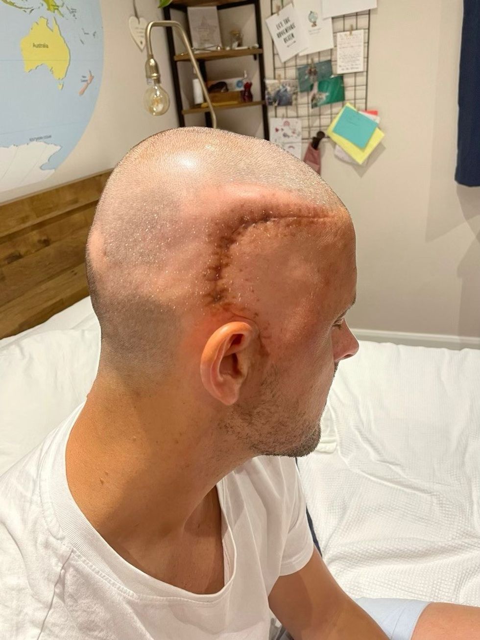 Man with scar on head