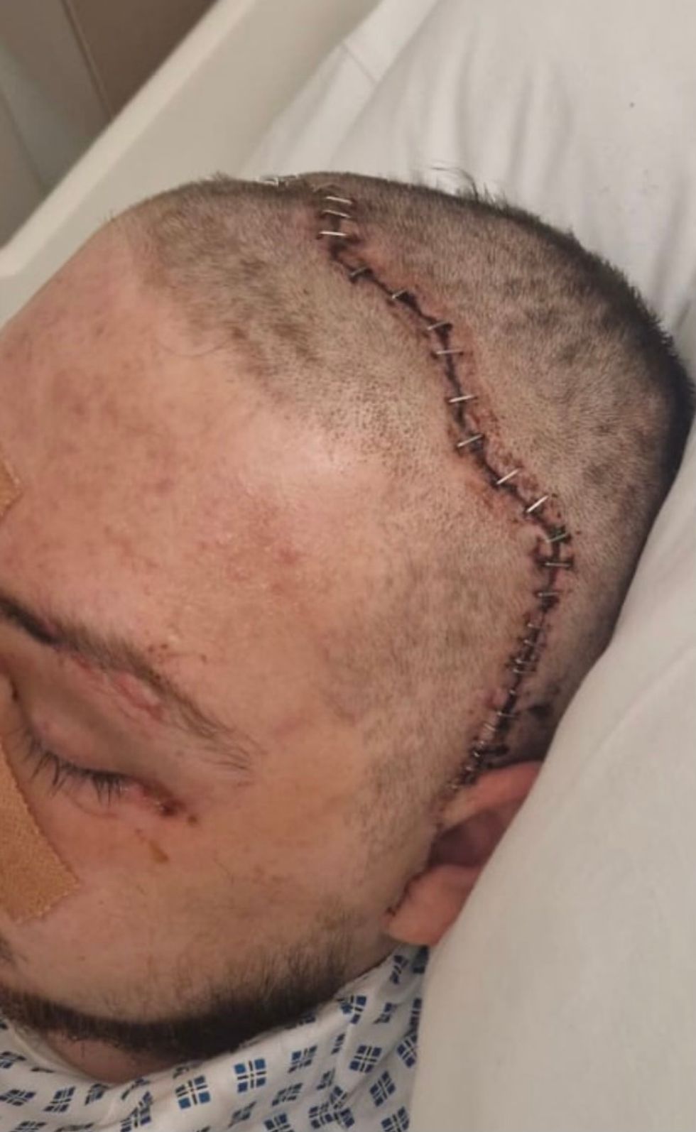 Man with scar on head