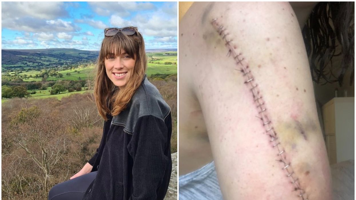 Woman endures years of cancer treatment only to discover she'd been misdiagnosed
