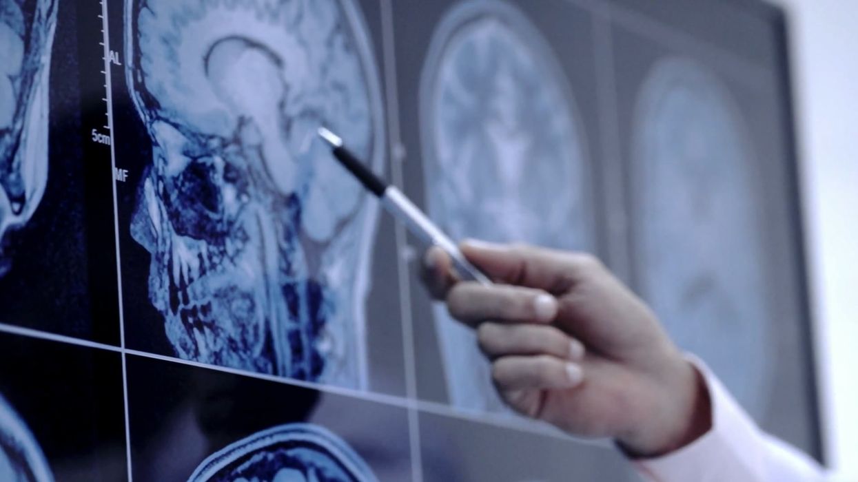 Scientists may have found a way to erase unwanted memories