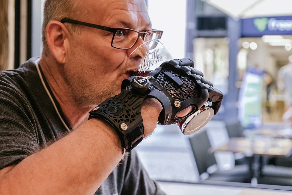Man, 52, who lost four of his fingers is fitted with ‘Hero Gauntlet’ by UK firm