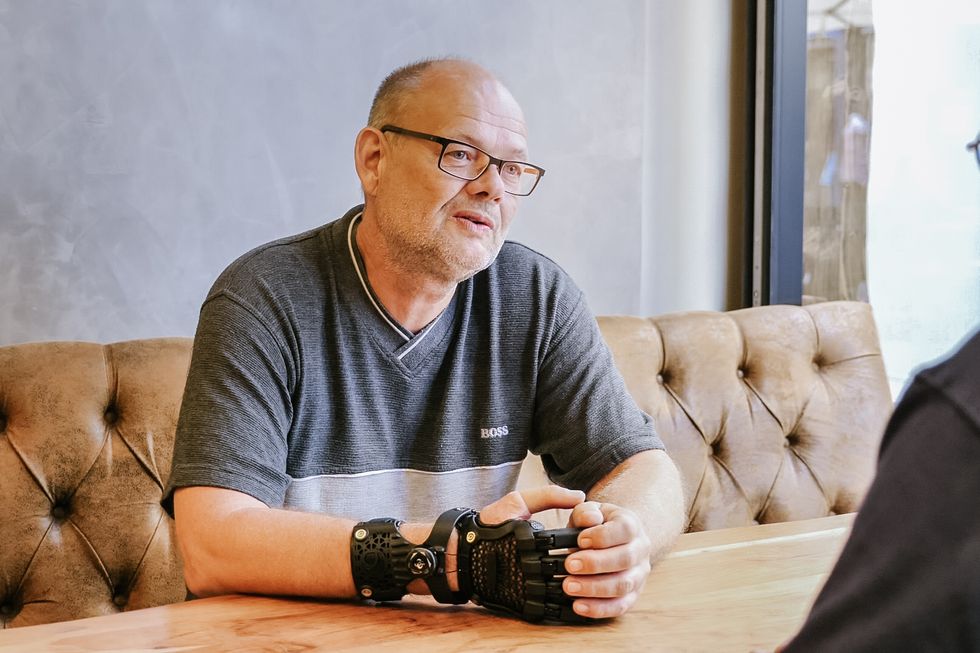 Michael Altheim, 52, of Frankfurt in Germany, was the first person in the world outside of prototypes to get a Hero Gauntlet from UK firm Open Bionics. (Open Bionics/ PA)