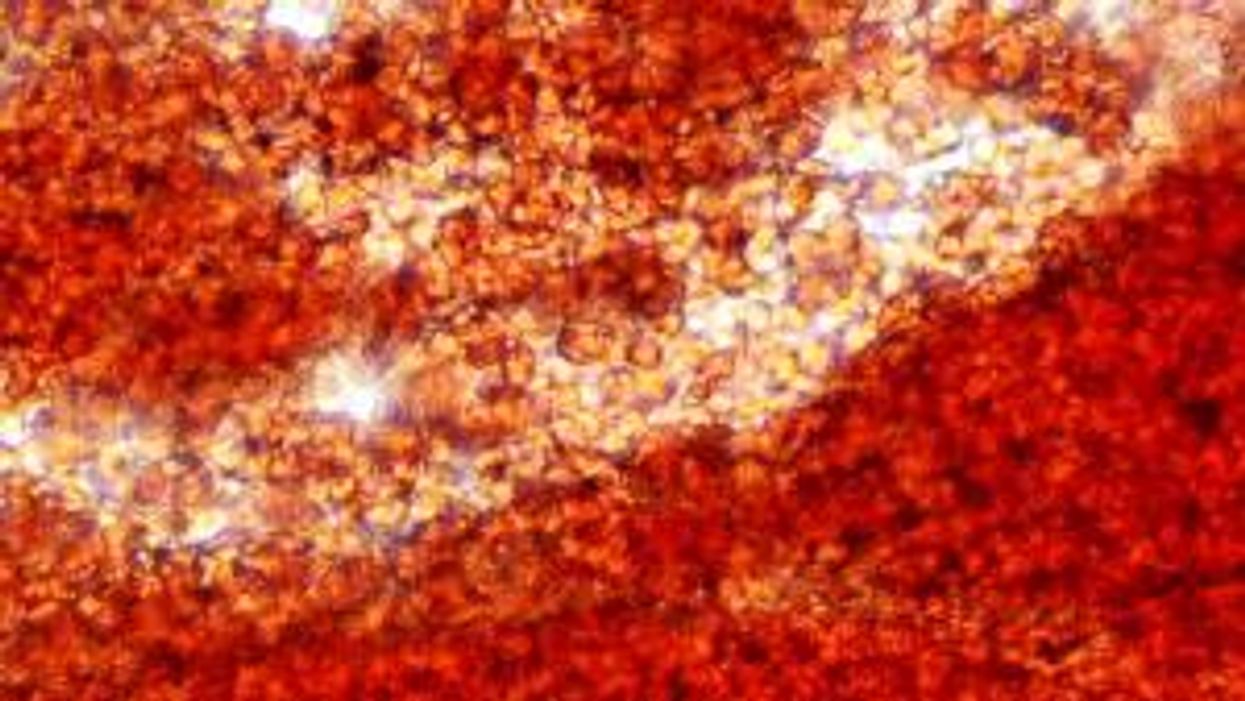 Microplastics could be in the blood of up to 8 in 10 people