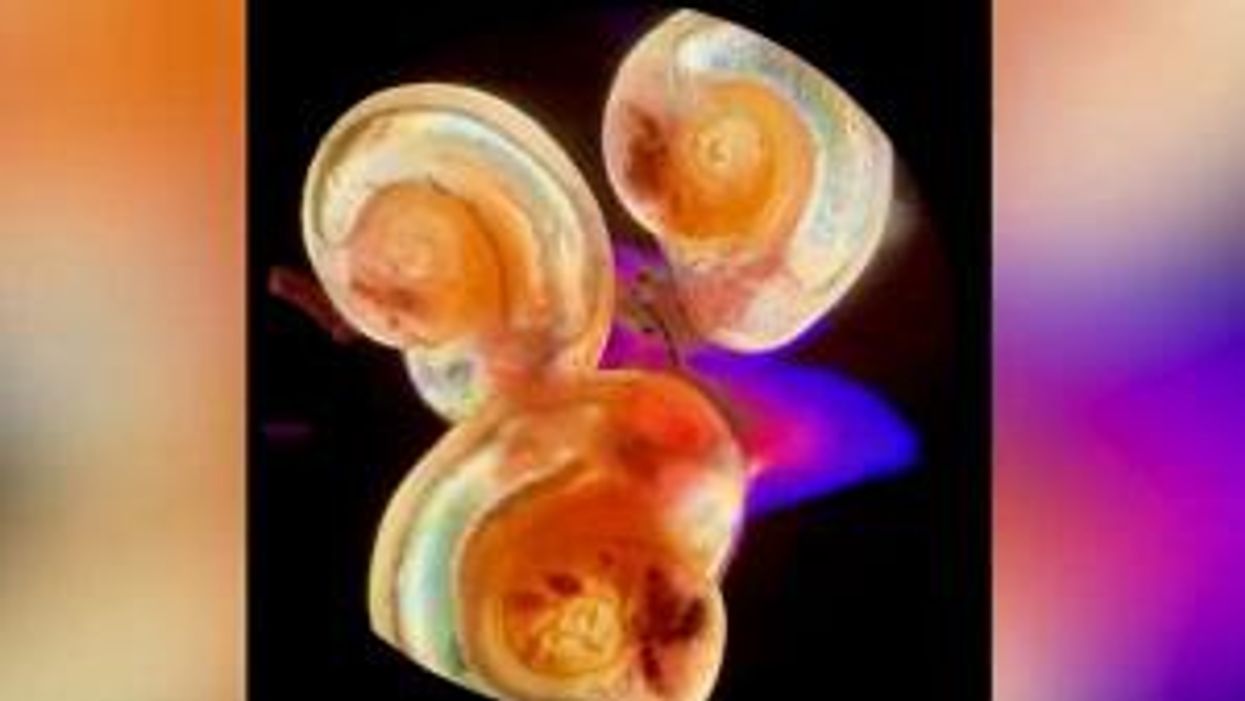 Viral TikTok telling people to 'drain their car doors' but people aren't convinced it's real