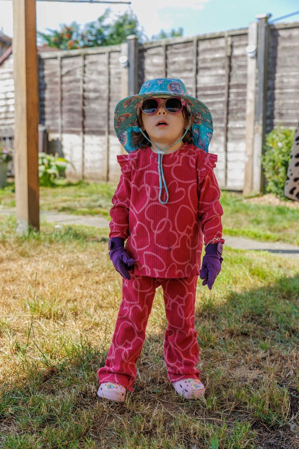 Mollie Murray, 2, pictured at home in protective full-length clothing, including hat, gloves and sunglasses, which she has to wear to play safely outside given her genetic disorder (The Archie Foundation/Newsline Media/PA)