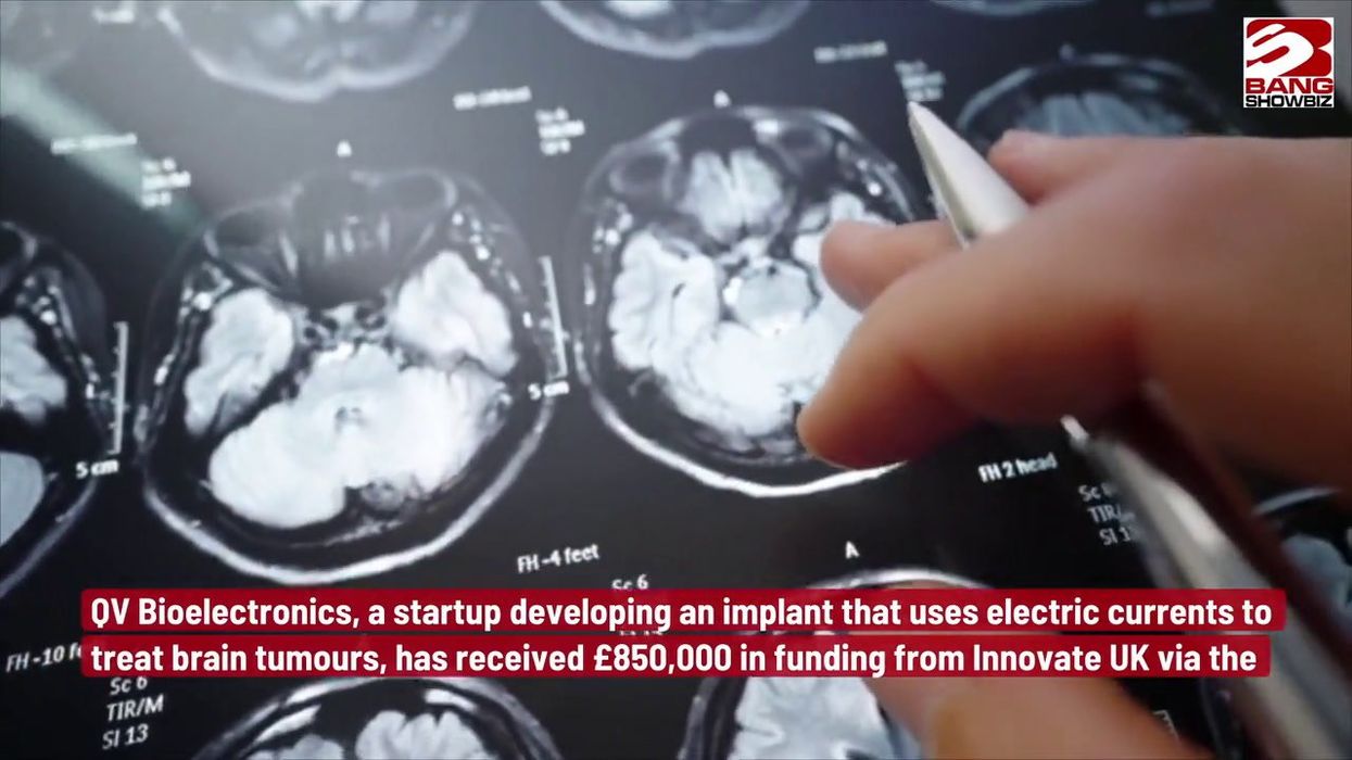 Scientists discover that human memory might be unreliable after just a few seconds