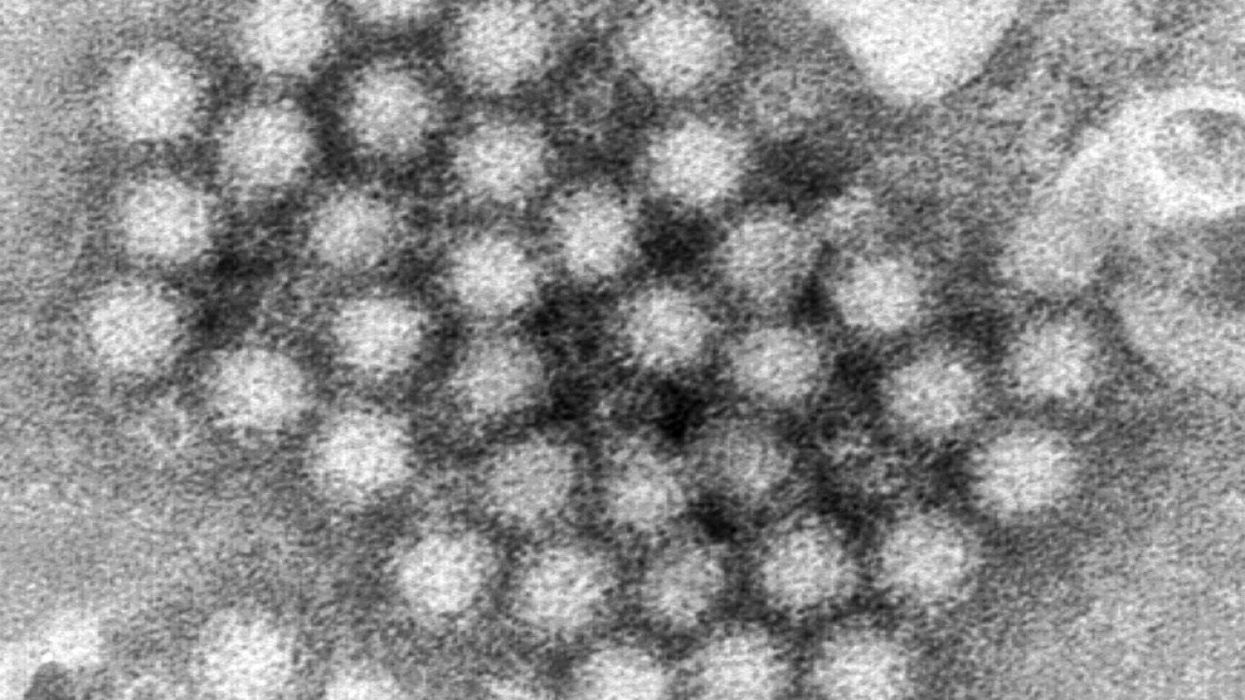 Highly contagious UK Winter bug: Best TikTok tips from health experts to avoid Norovirus