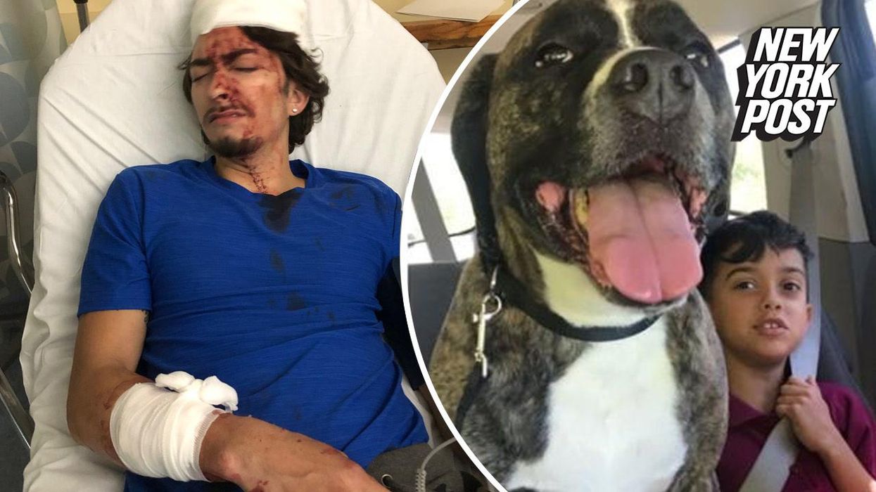 Nine-year-old boy almost had his lip ripped off in horror dog attack