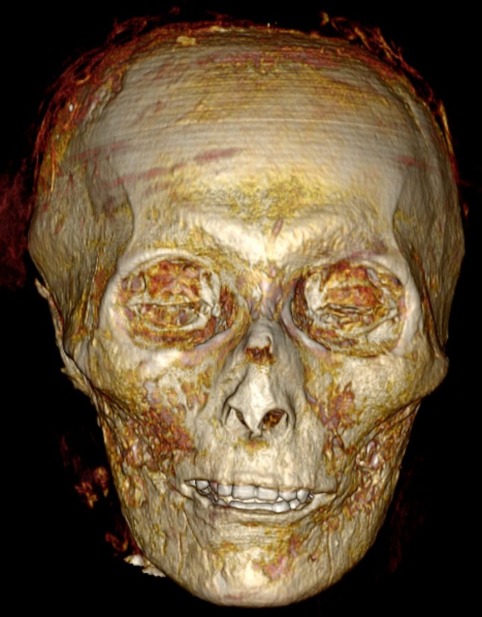 (PA/ Sahar Saleem and Zahi Hawass) A three-dimensional CT scan of Pharaoh Amenhotep I