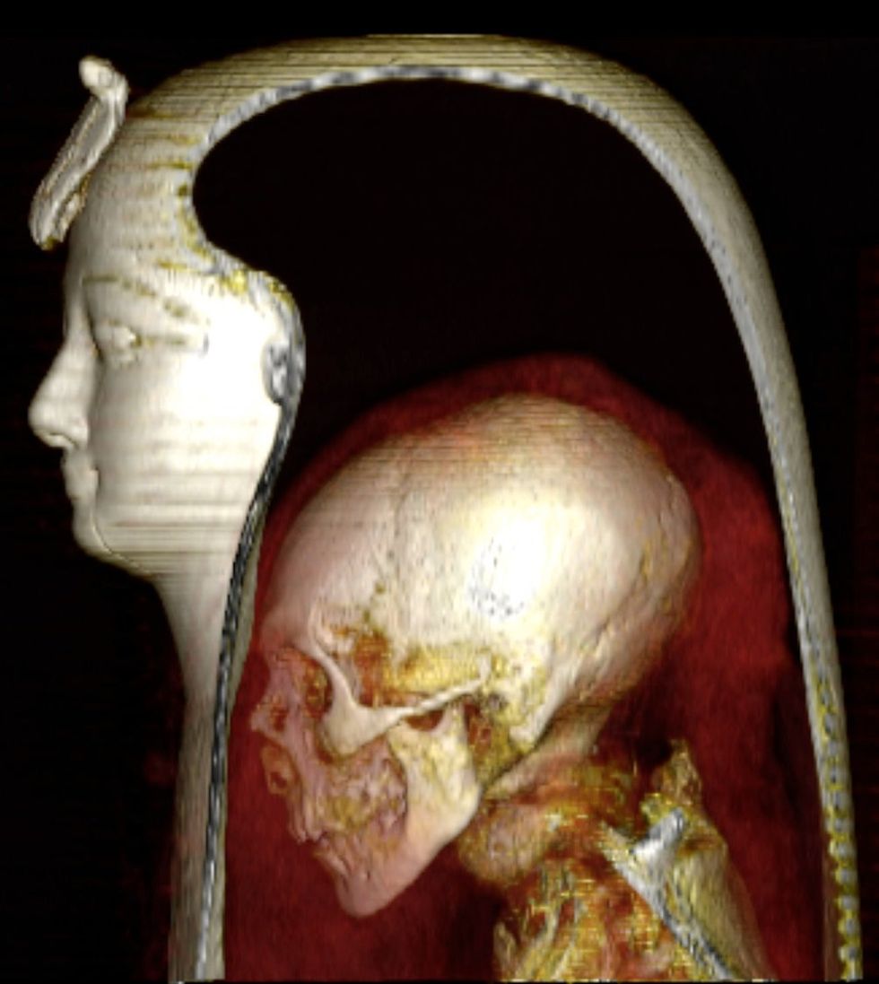 (PA/ Sahar Saleem and Zahi Hawass) A three-dimensional CT scan of Pharaoh Amenhotep I