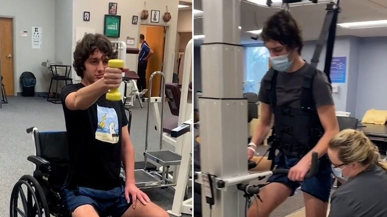 Man breaks his nose after flexing too hard at the gym