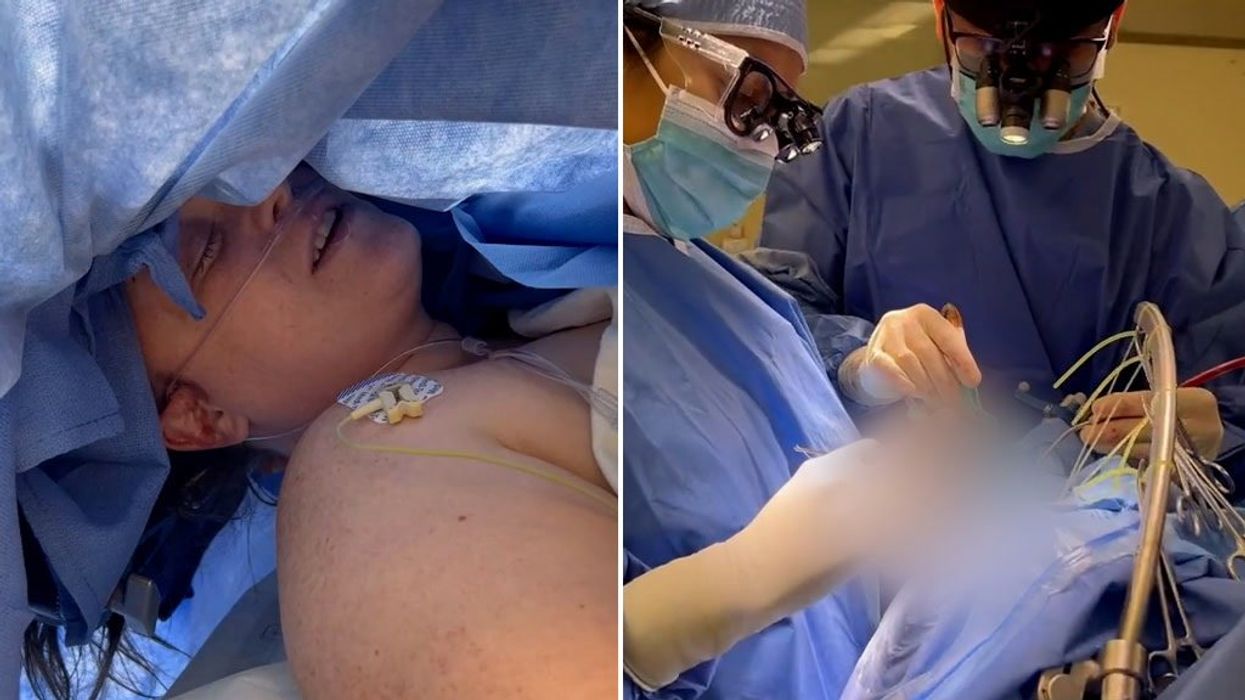 Patient stuns by singing Moana songs during brain surgery - for medical reason