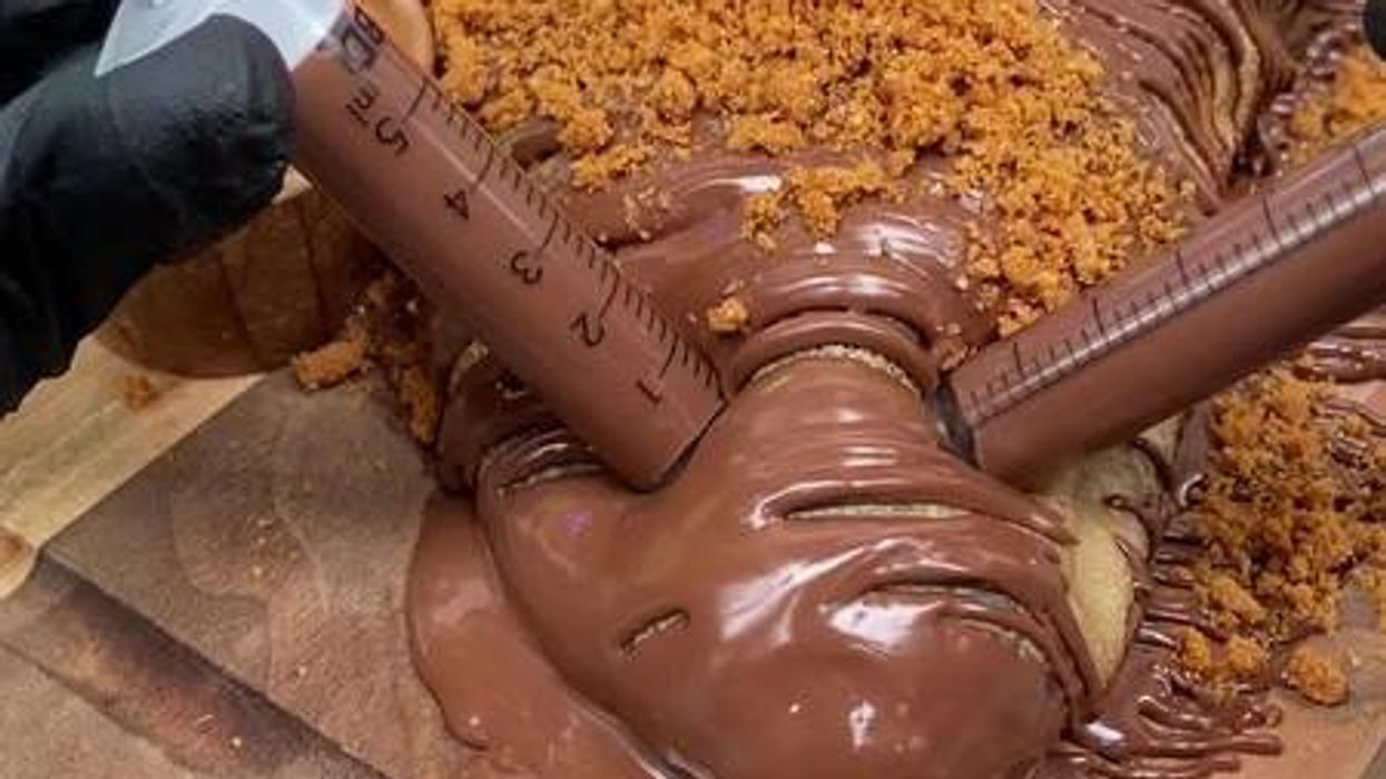 Man left mortified after having 'brown moles' checked by doctor