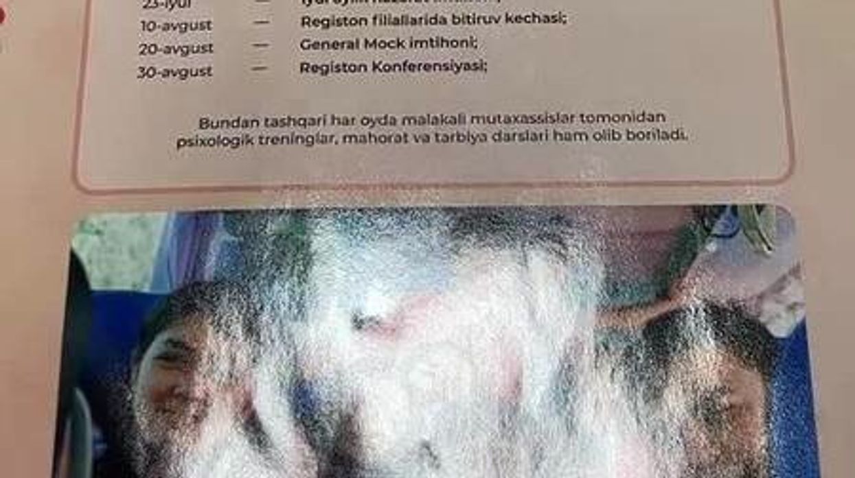 Woman accidentally swallows AirPod after mistaking it for a vitamin