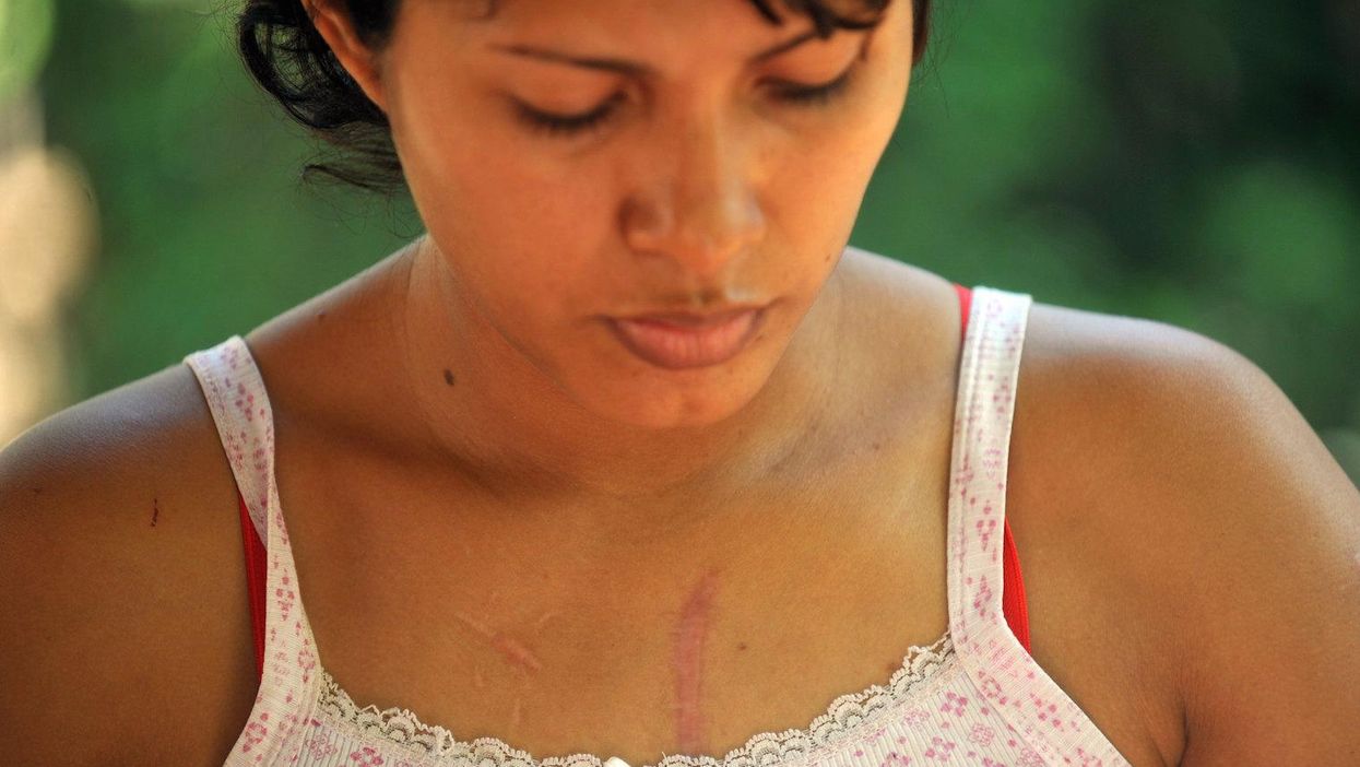 Picture: HECTOR RETAMAL/AFP/Getty Images