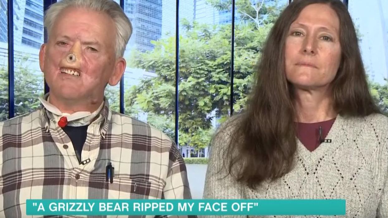 Face Rip Off This Morning viewers claim man who had face ripped off by bear ...