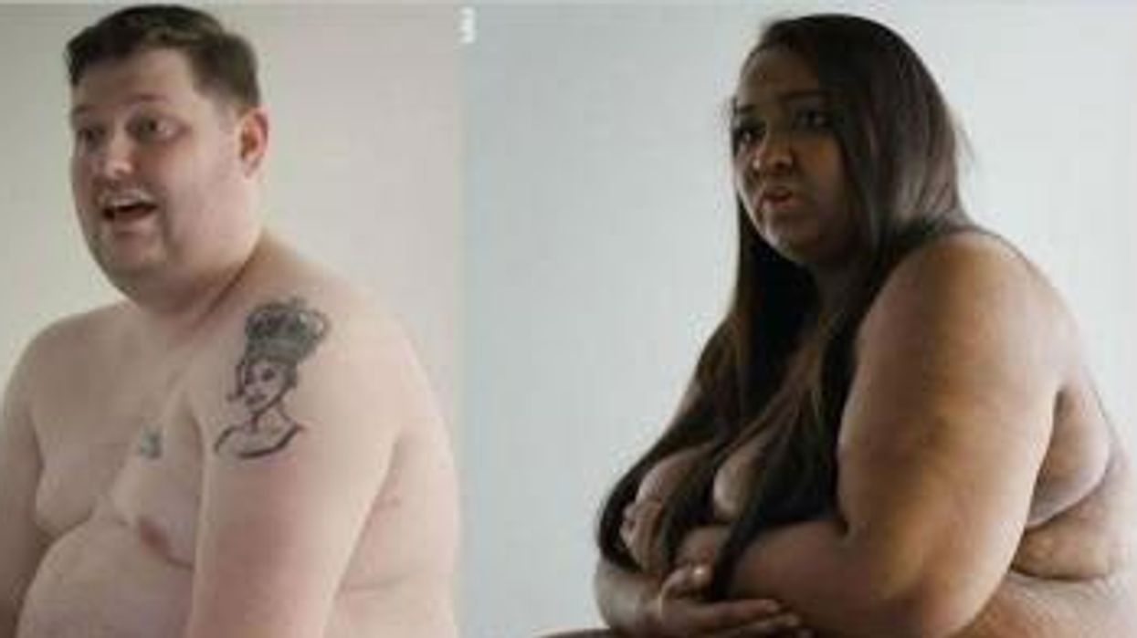 People With Obesity Naked