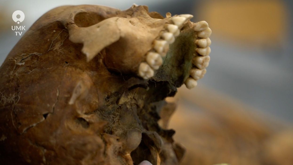 Face of man suspected of being a vampire is reconstructed