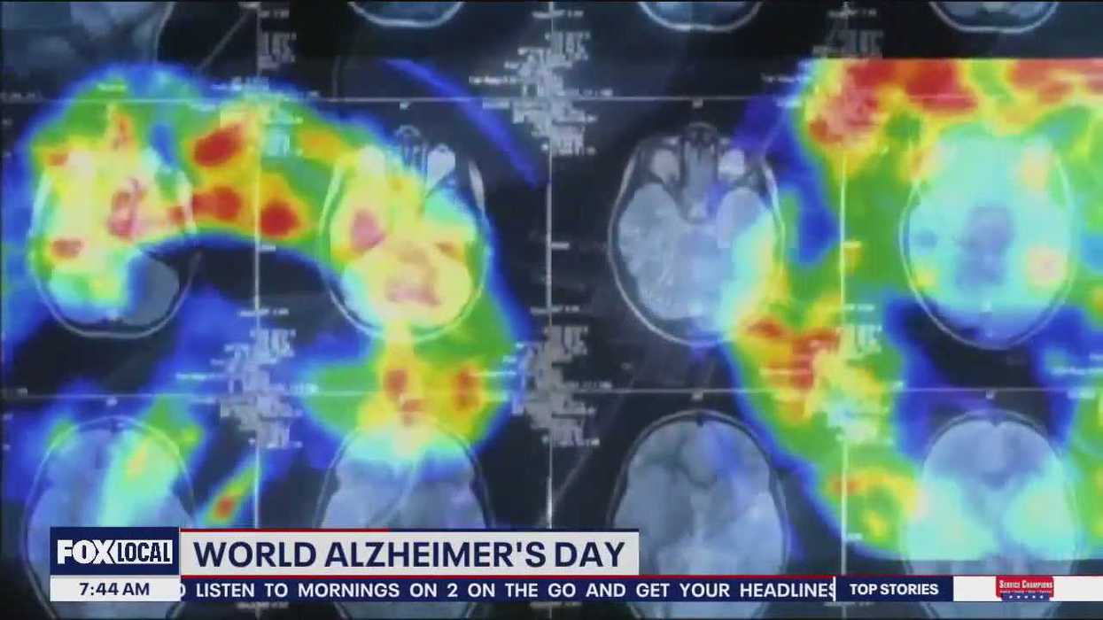 Is your lifestyle increasing your risk of Alzheimer’s?