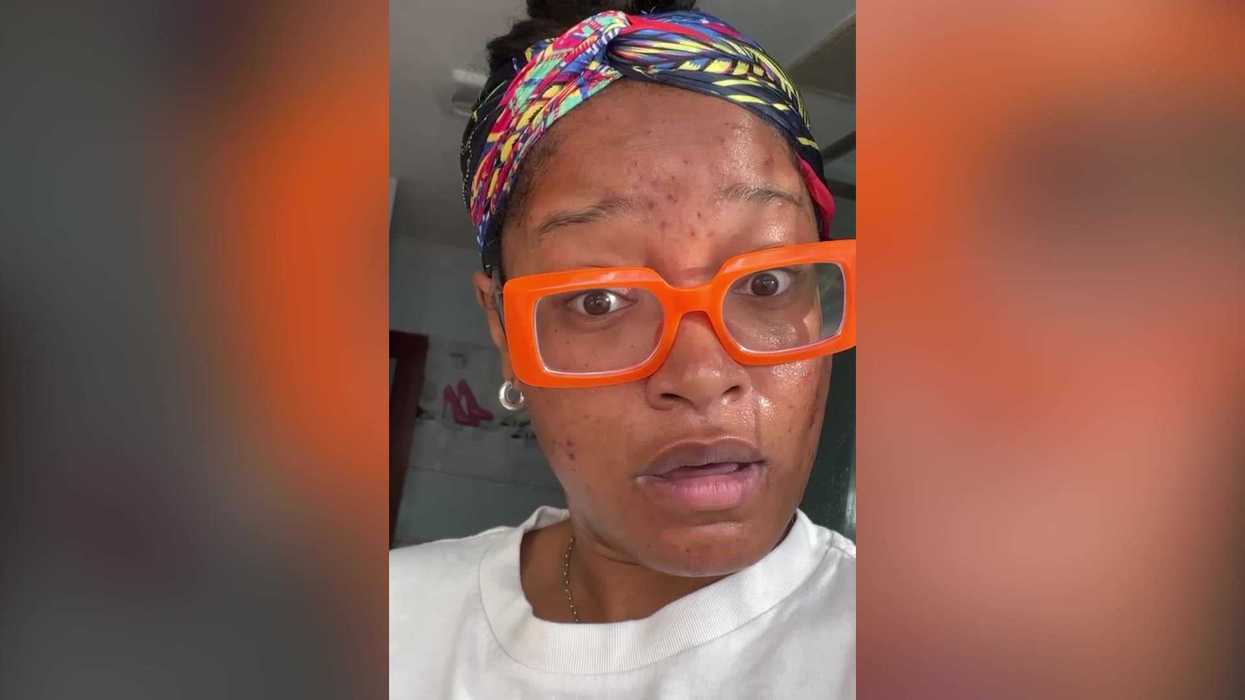 Your dirty mobile phone is causing skin breakouts and irritation experts warn