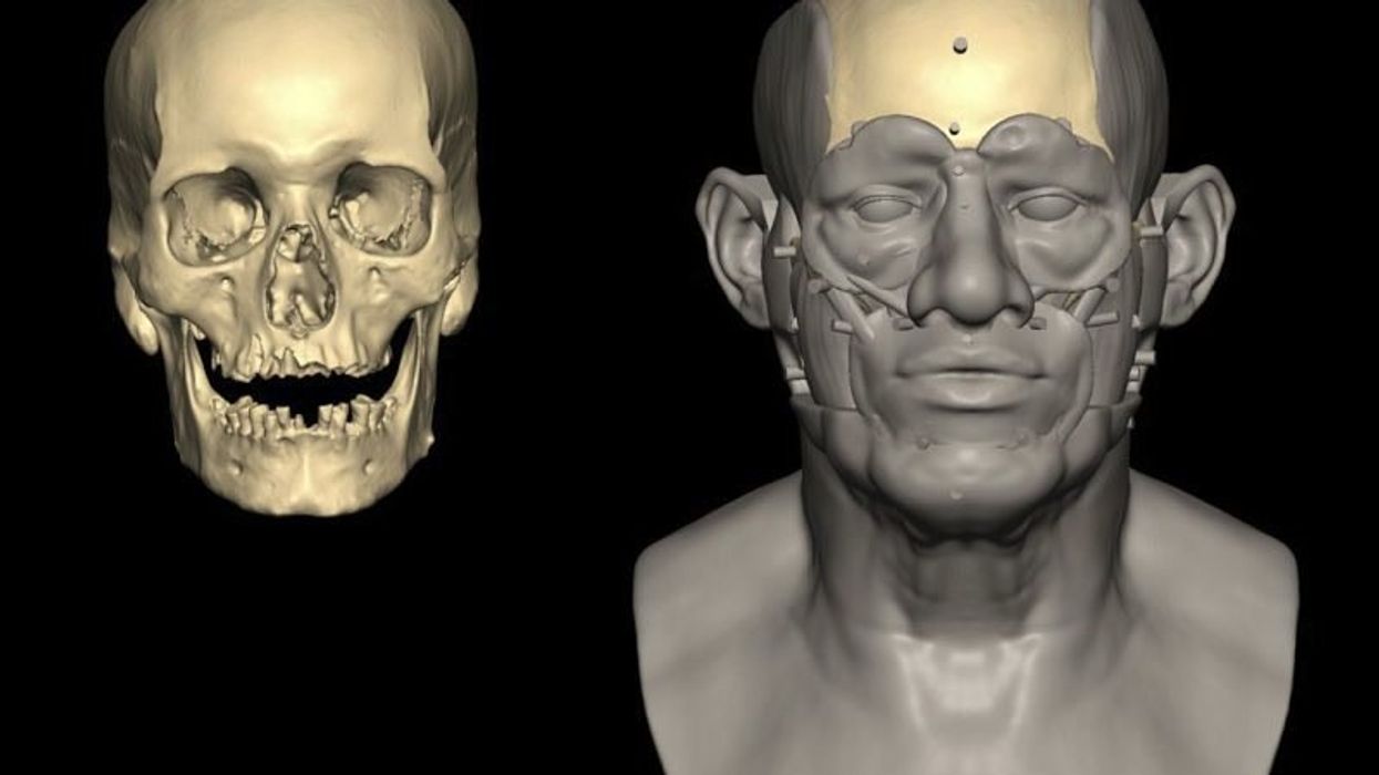 Ancient DNA study suggests one thing is to blame for ‘new era of disease’ in humans