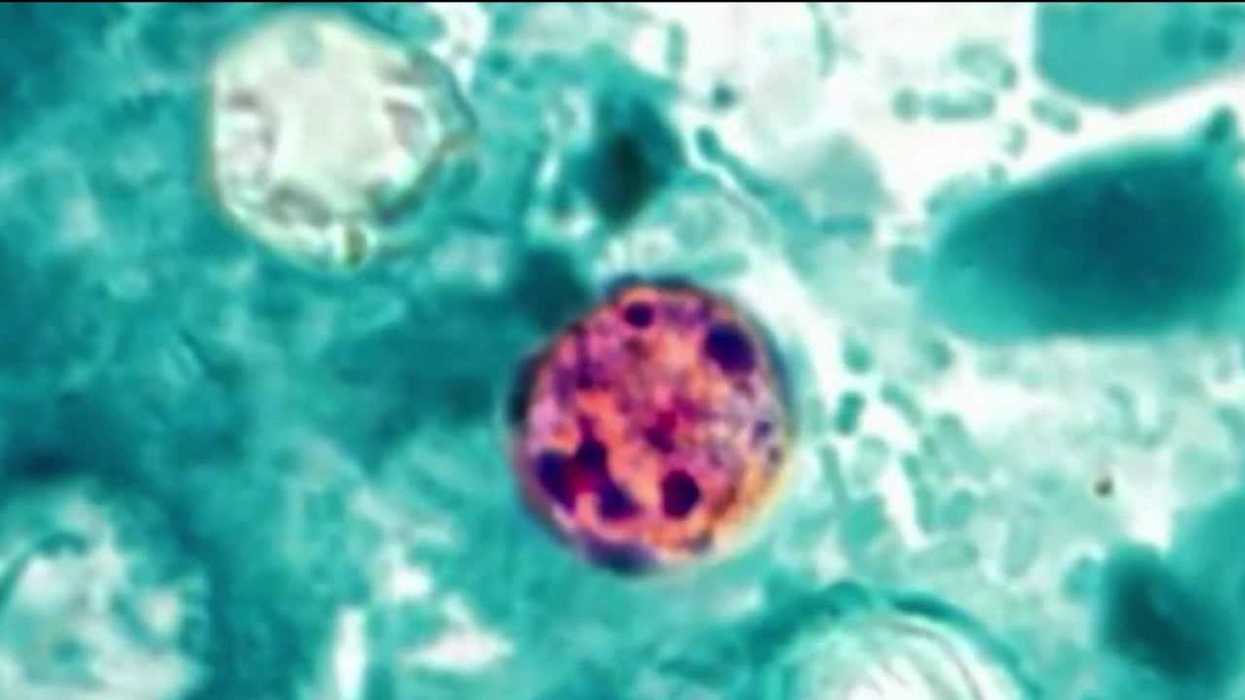 Trump administration reportedly cancels research into very parasite making Americans sick right now
