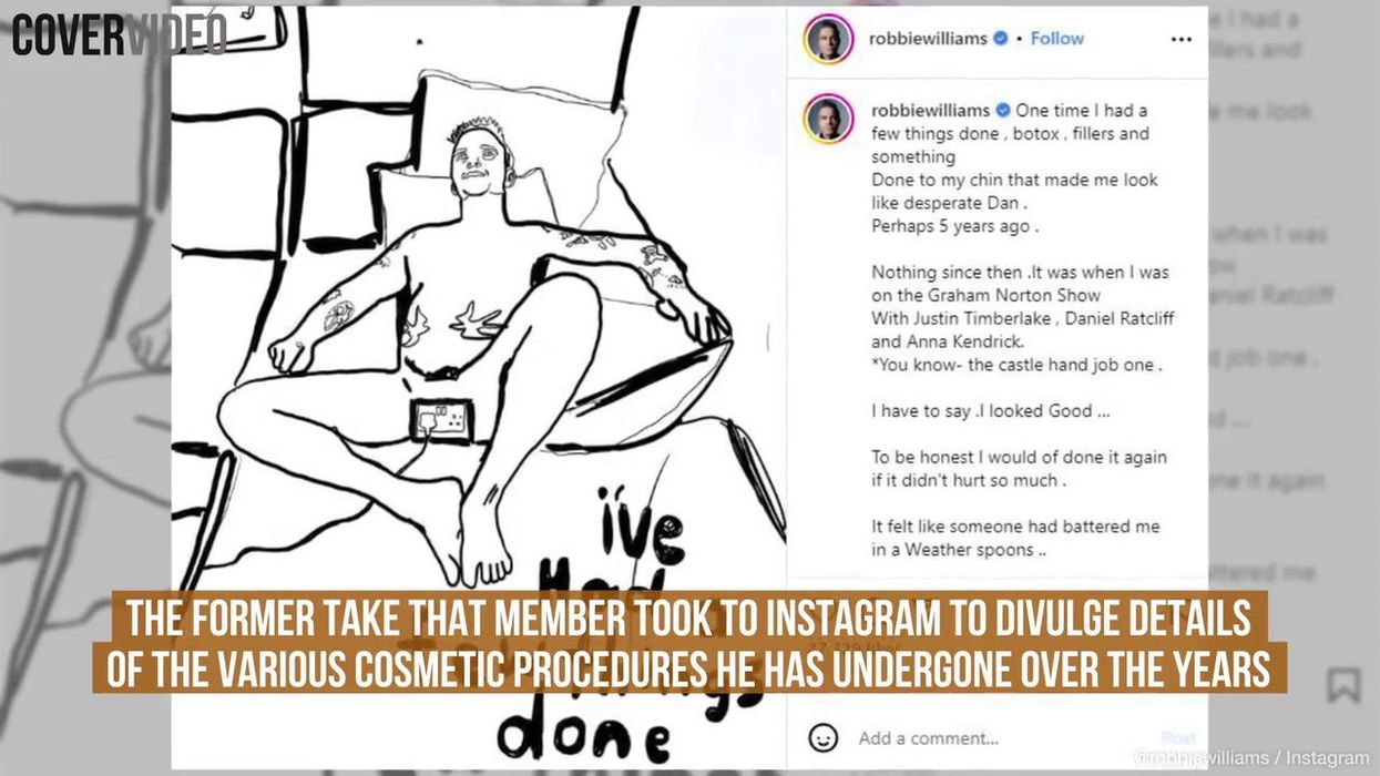 Robbie Williams reveals his most horrendous on stage moment: "Let sleeping logs lie"