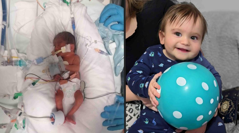 Baby born weighing just 1lb ‘doing brilliantly’ as he celebrates first birthday