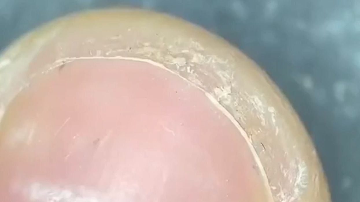 Video of strawberry under a microscope will make you never want to eat one again
