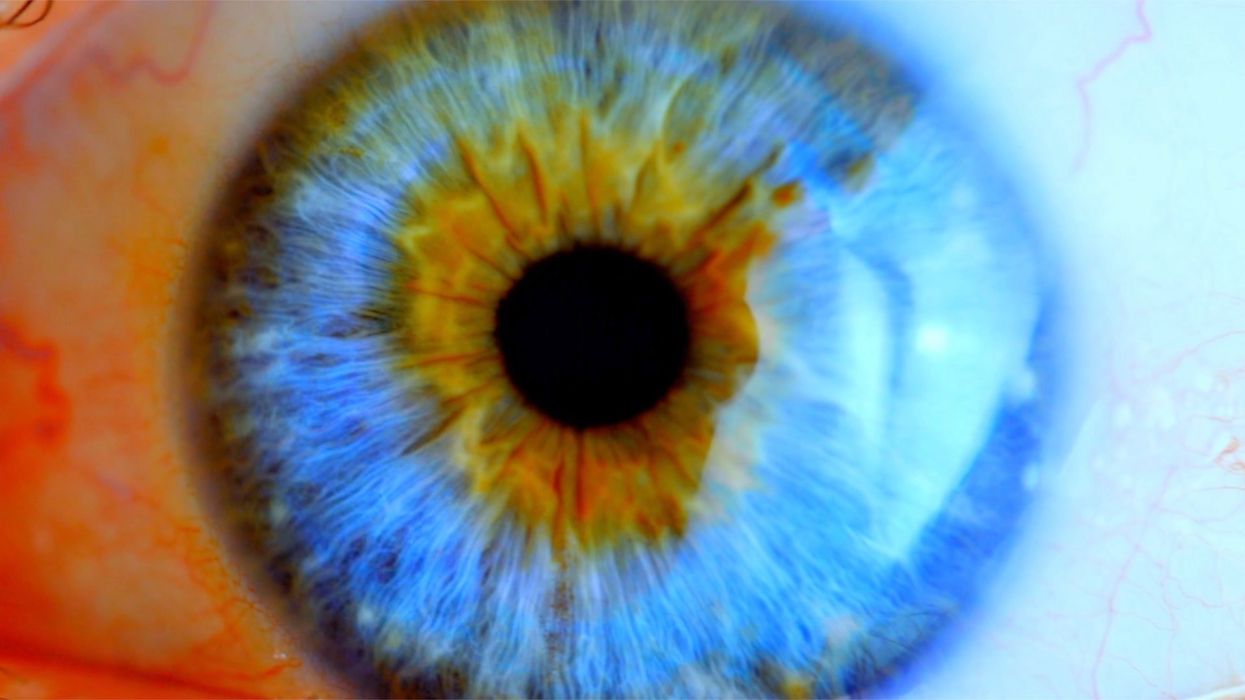 Doctor suggests Gen Z faces terrifying blindness epidemic