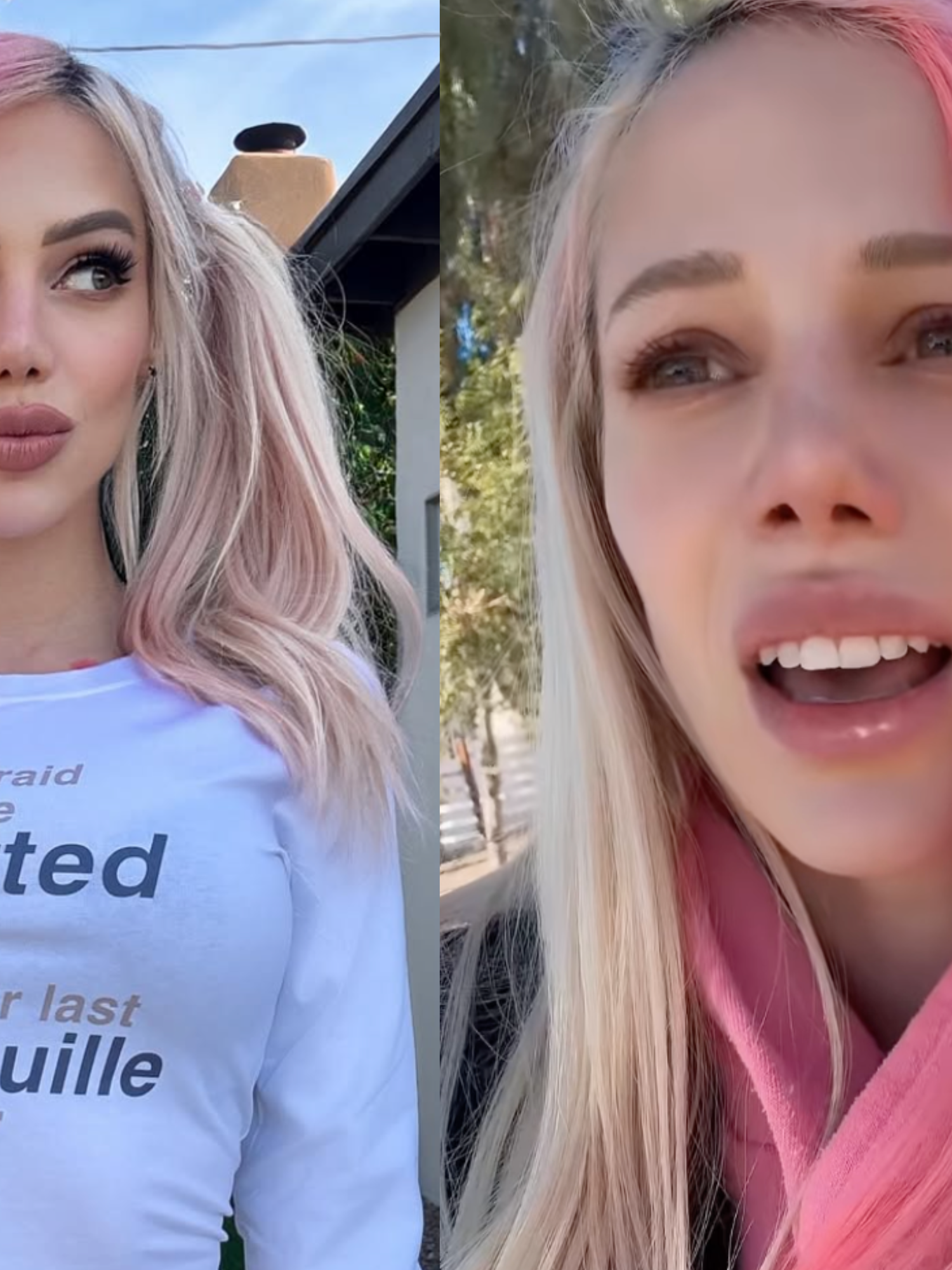 Singer claims she's been left with bone-thinning disease after taking Ozempic