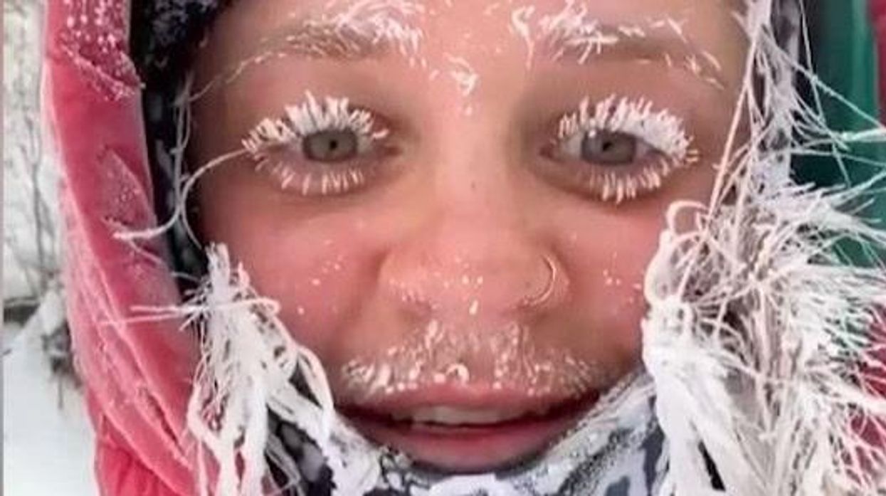 Sub-zero temperatures in Montana freeze woman's eyelashes and hair