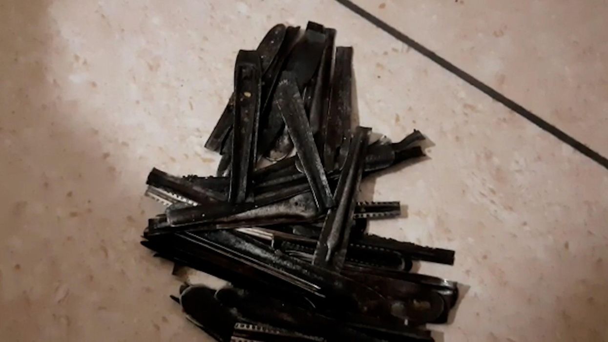 Surgeons remove 63 spoons from man's stomach after he ate them for a year