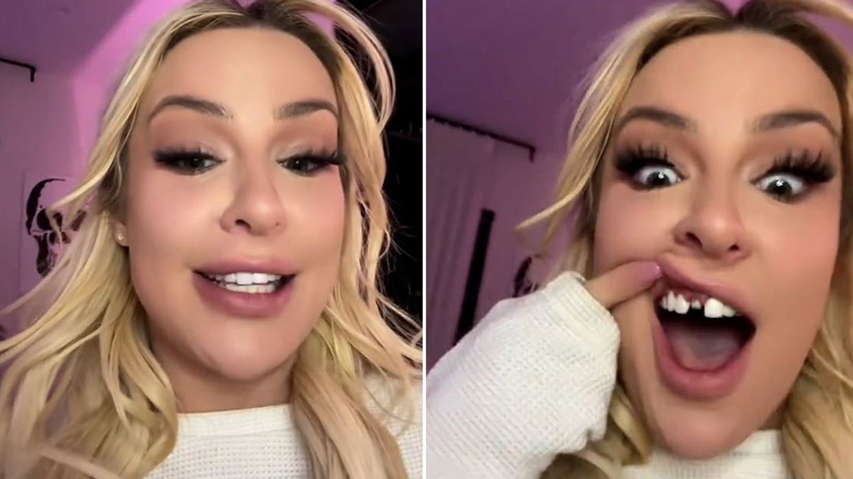 Tana Mongeau captures horrifying moment veneer falls out on camera