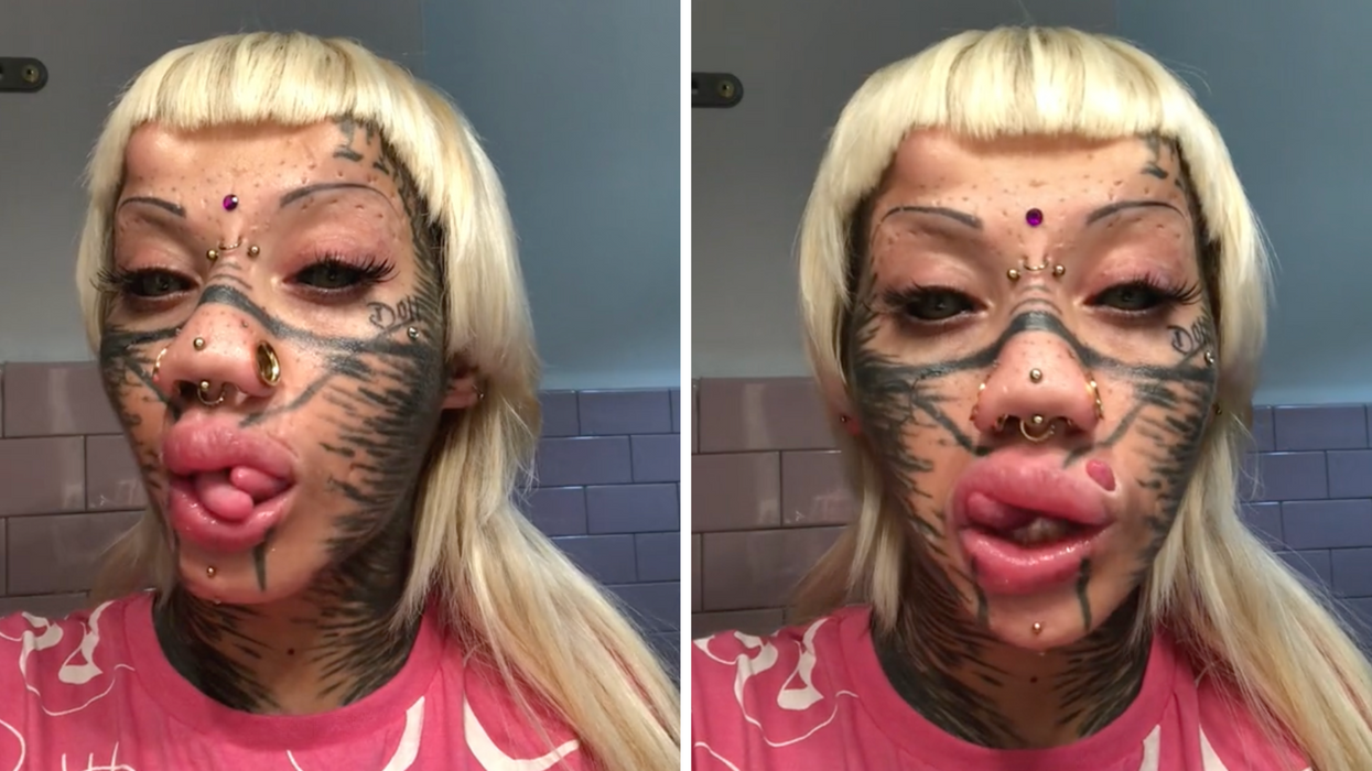 Woman undergoes 20 surgeries to transition into a cat