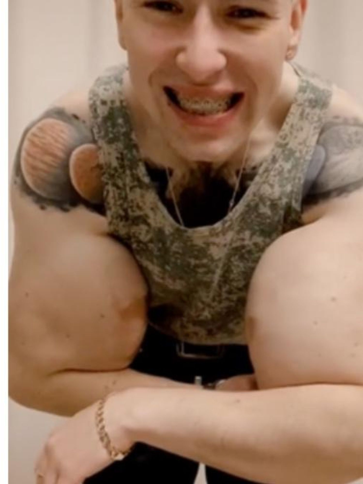 Man dubbed 'Russian Popeye' flexes huge jelly injected arms sparking concern